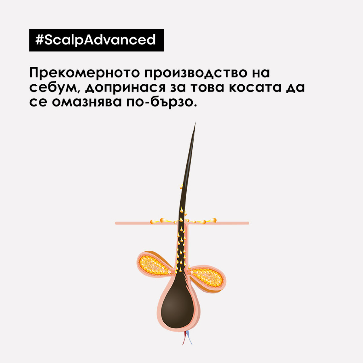 Балансиращ шампоан против омазняване Loreal Professionnel Scalp Advanced Anti-Oiliness Shampoo 300ml